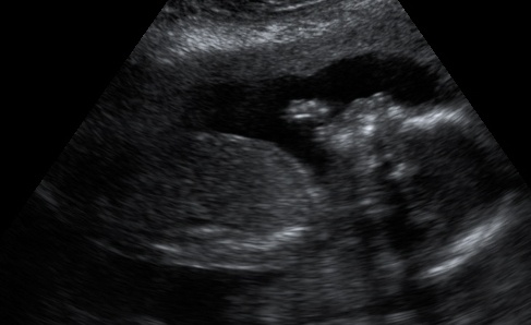 Josiah in the Womb